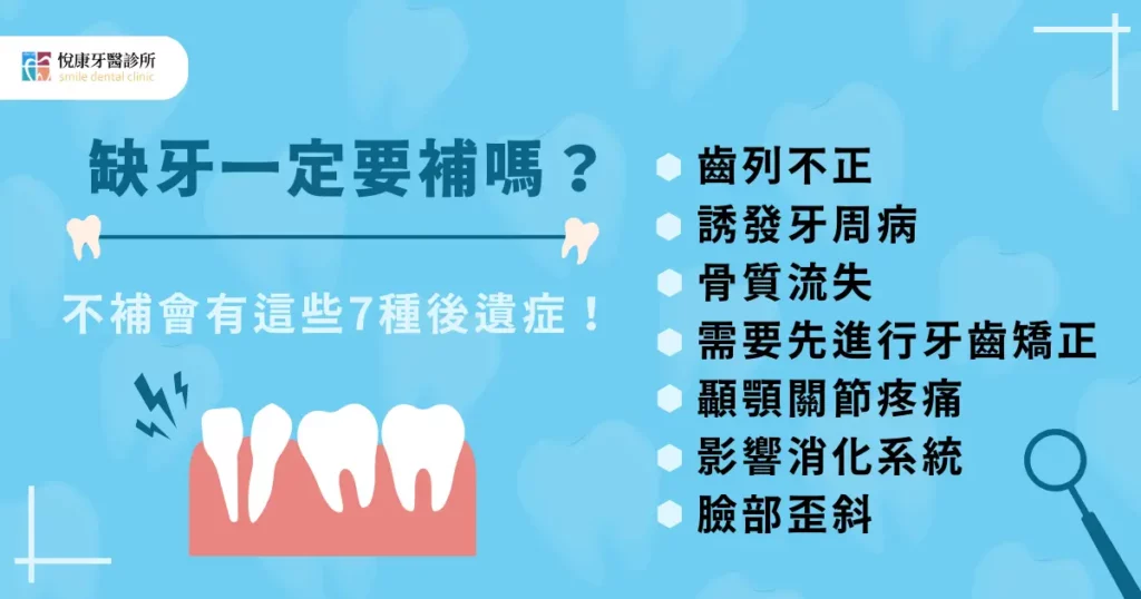 缺牙一定要補嗎？不補會有這些 7 種後遺症！
