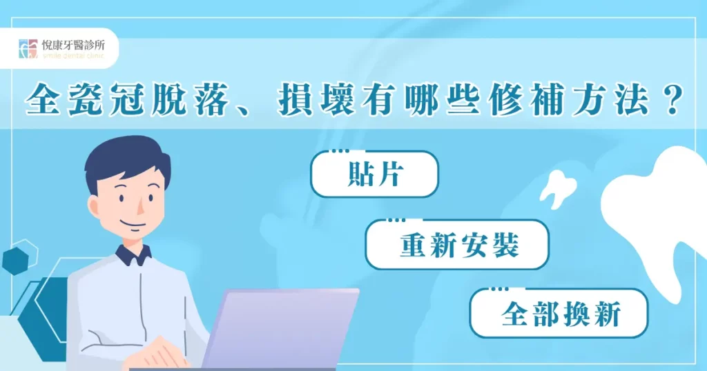 全瓷冠掉了該怎麼辦?為什麼會出現脫落情形? 2 全瓷冠脫落、損壞有哪些修補方法?