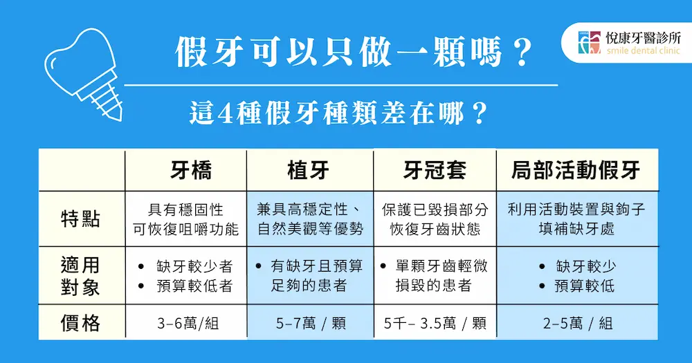 假牙可以只做一顆嗎?單顆假牙費用要怎麼算? 1 假牙可以只做一顆嗎?這 4 種假牙種類差在哪?